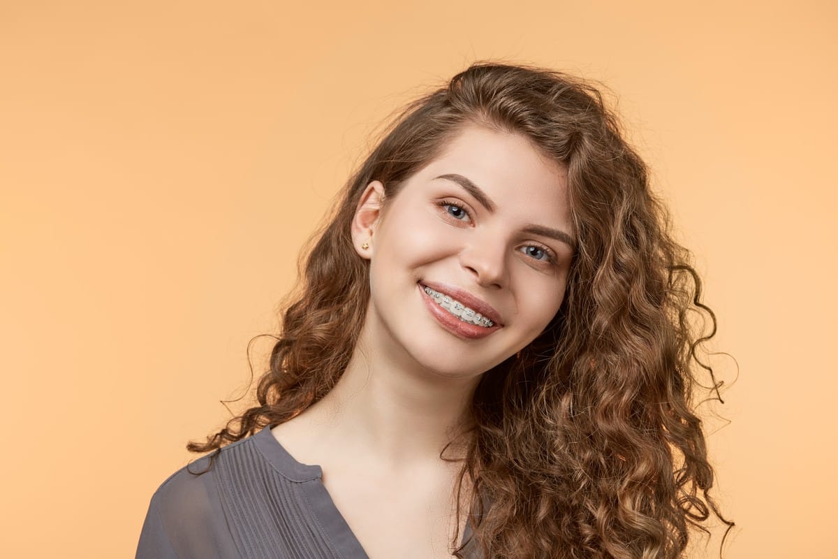 Braces Options for Metal Allergies