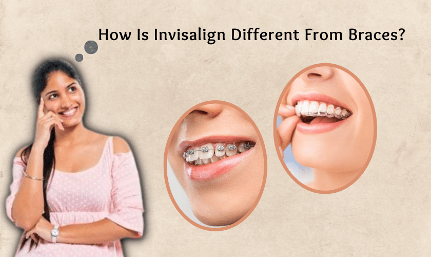 How Is Invisalign Different From Braces?