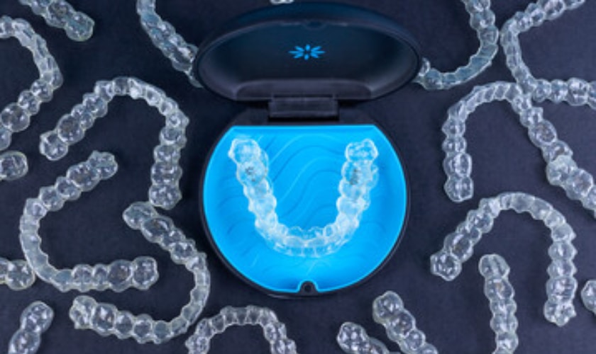 Does Invisalign Clear Aligners Effects Daily Life Style?