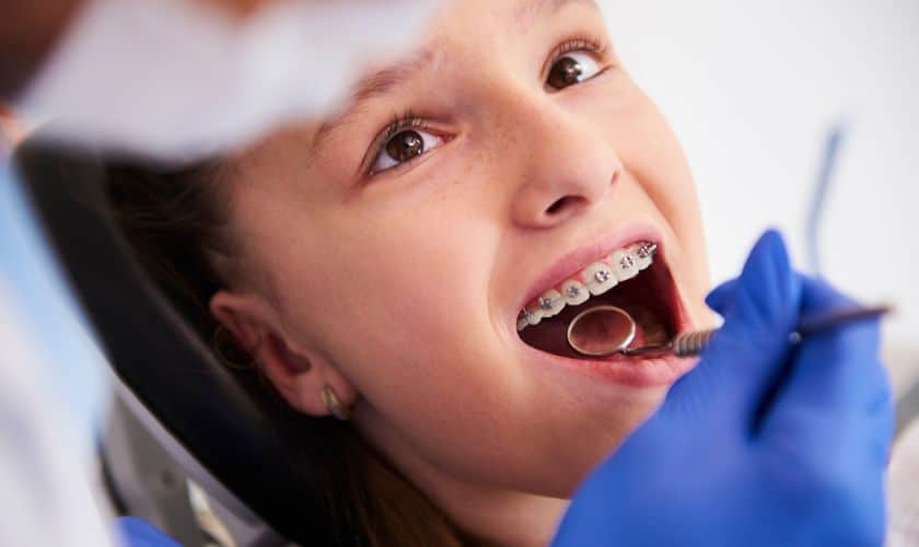 Braces