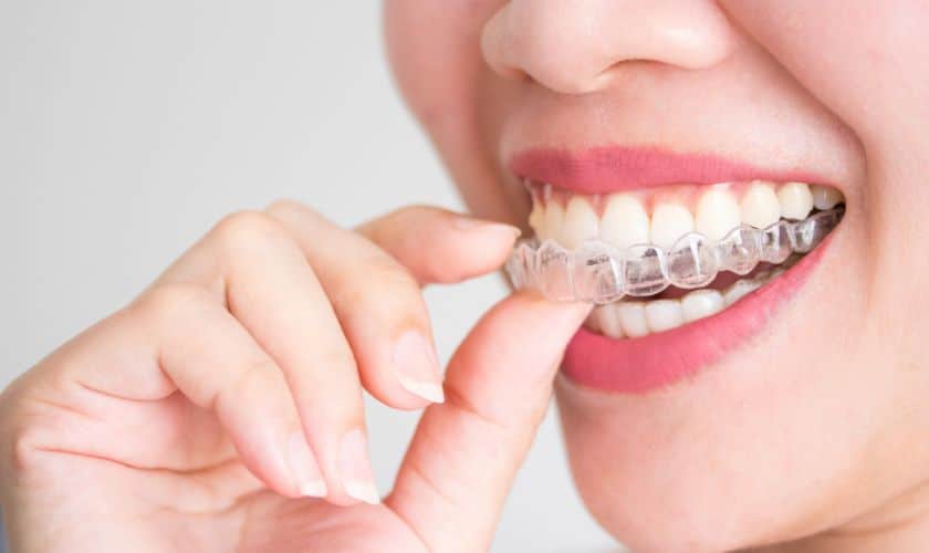 Invisalign treatment