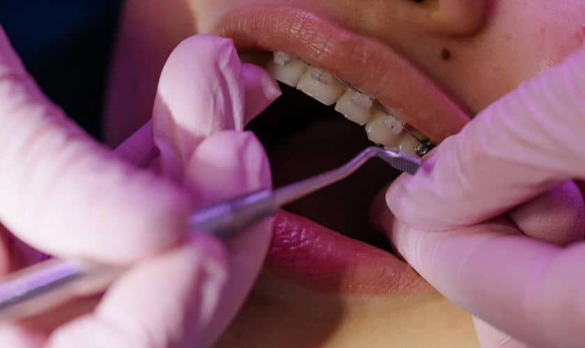 Braces In Maspeth