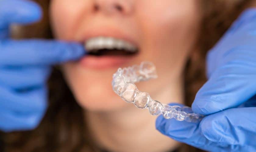 Invisalign in Merrick