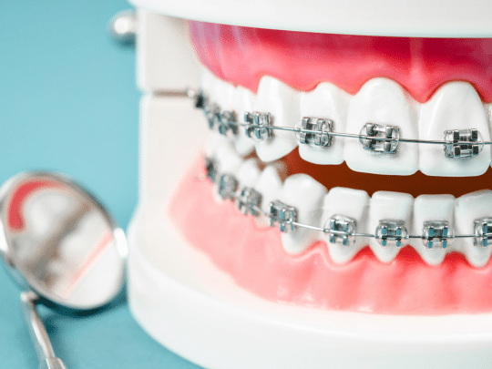 Enjoy a Brighter Smile with Best Orthodontics in Maspeth