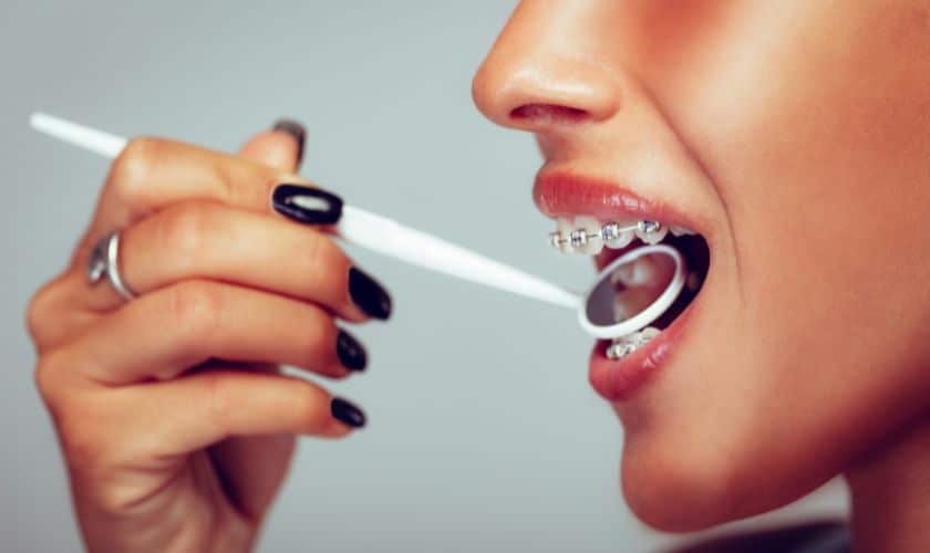Braces In Maspeth