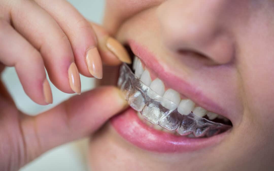 Celebrating Mom’s Smile This Mother’s Day With Invisalign