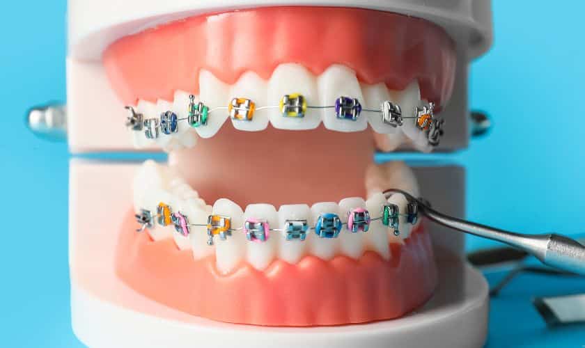 Orthodontist Jericho