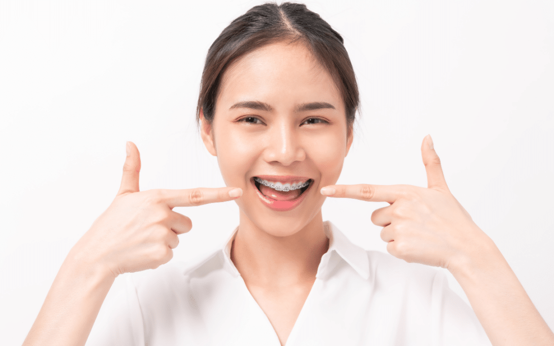 A Guide to Foods You Can and Can’t Eat with Braces