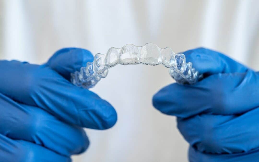 The Ultimate Guide to Properly Cleaning Your Invisalign Aligners