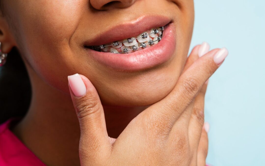 Is There an ‘Ideal Age’ for Orthodontic Treatment?