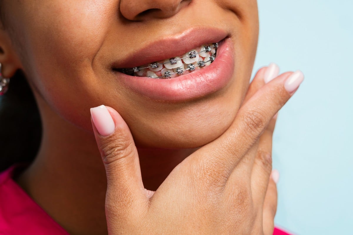 Person smiling with metal braces on teeth against light blue background