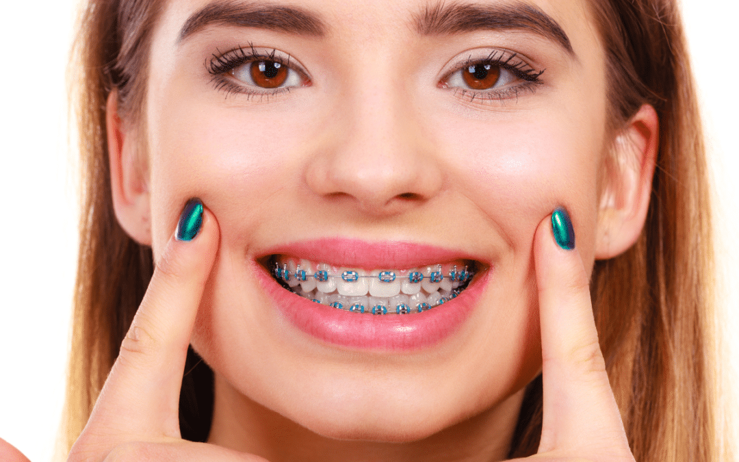 Top 10 Reasons to See an Orthodontist Before Turning 30