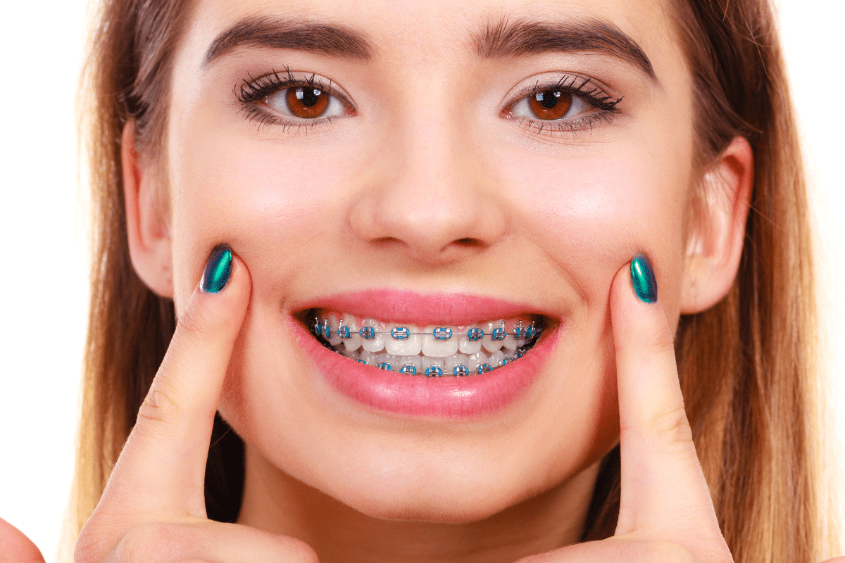 Top 10 Reasons to See an Orthodontist Before Turning 30