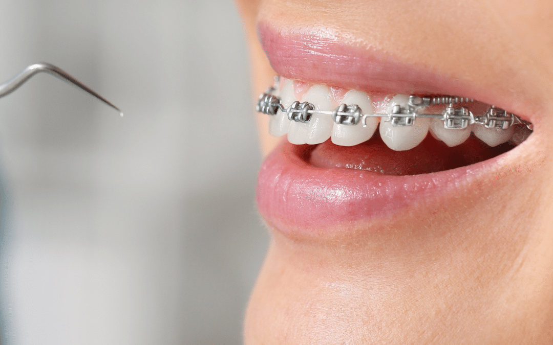 Why a Visit to an Orthodontist Could Be Your Smile’s Best Move?