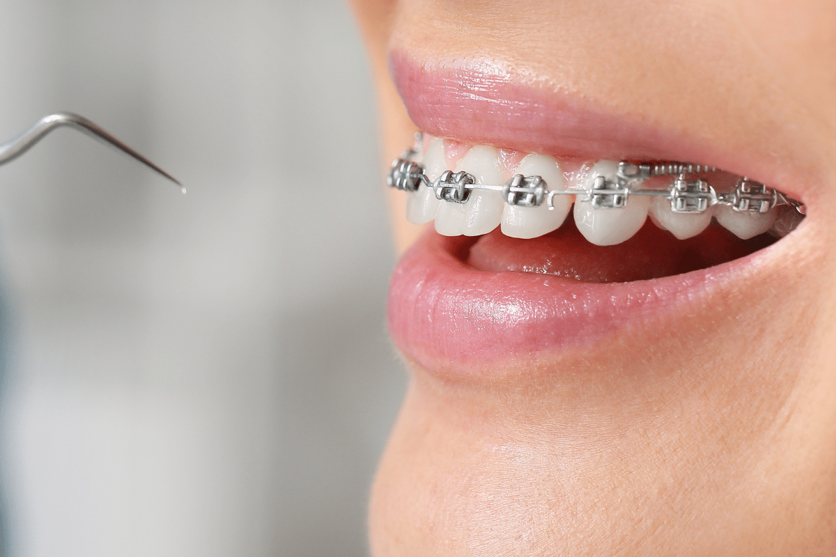 Why a Visit to an Orthodontist Could Be Your Smile's Best Move?