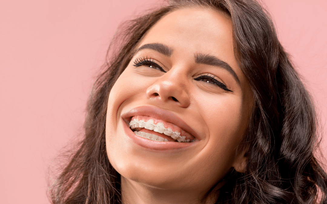 Shedding Light on Adult Braces: Myths and Facts