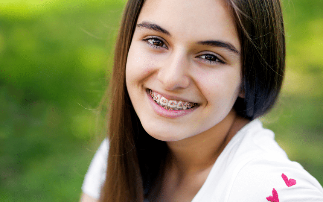 Adult Braces: A New Approach to Anti-Aging and Oral Health