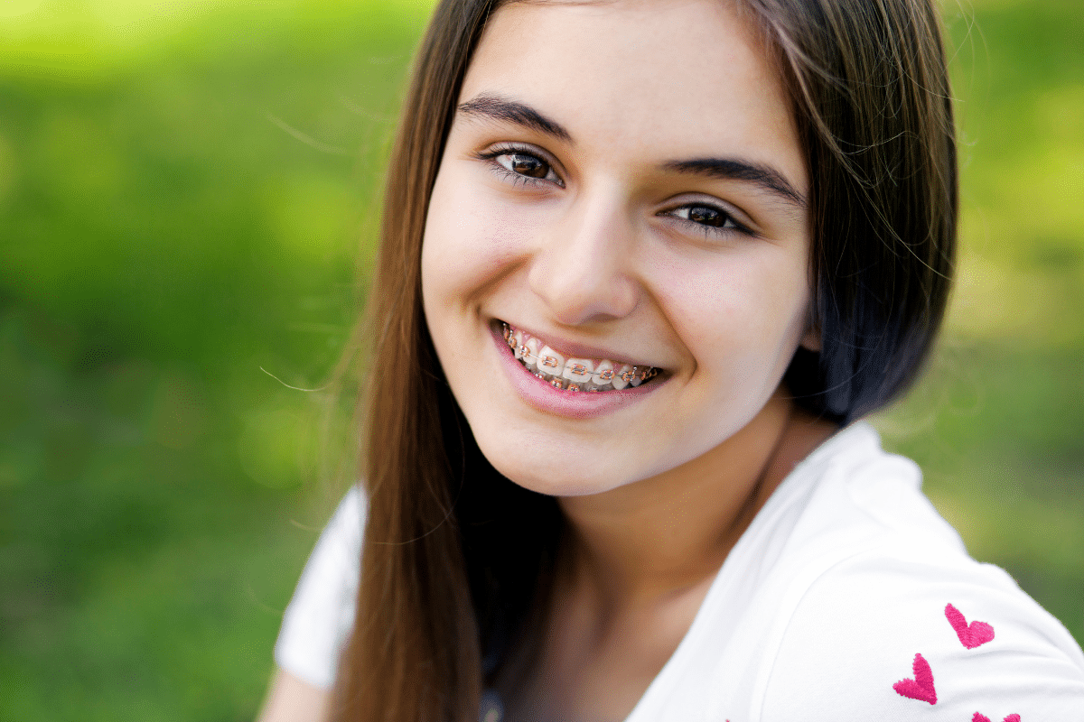 Adult Braces- A New Approach to Anti-Aging and Oral Health