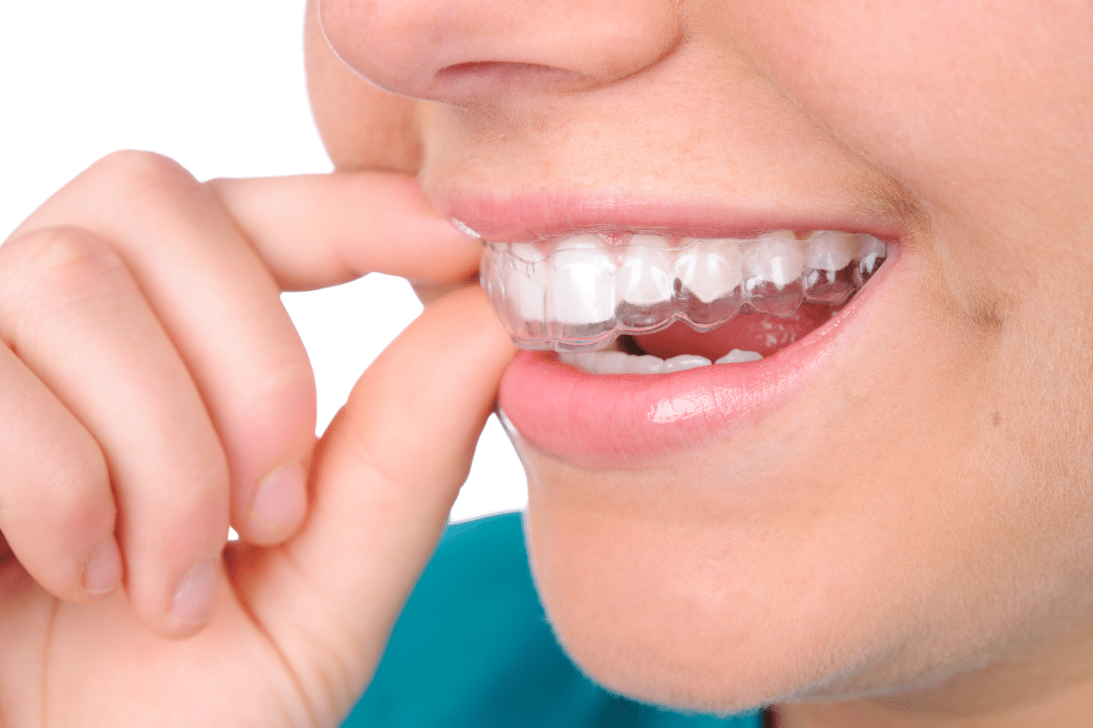 Why Our Orthodontist in Maspeth, Jericho, Merrick Recommends in Retainers After Braces
