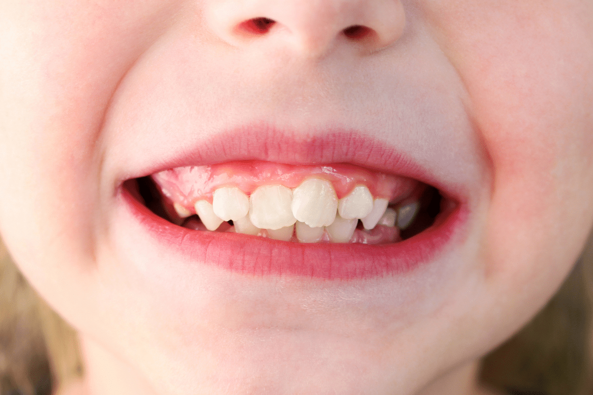 Common Orthodontic Problems and Solutions from an orthodontist near you