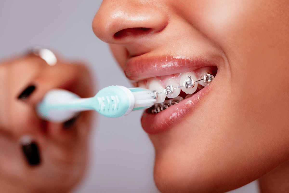 Tips for Brushing with Braces by Orthodontists in Jericho, Maspeth, Merrick