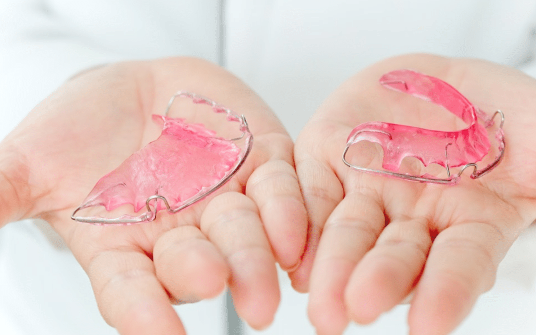 Can Retainers Fix an Overbite? Here’s What You Should Know