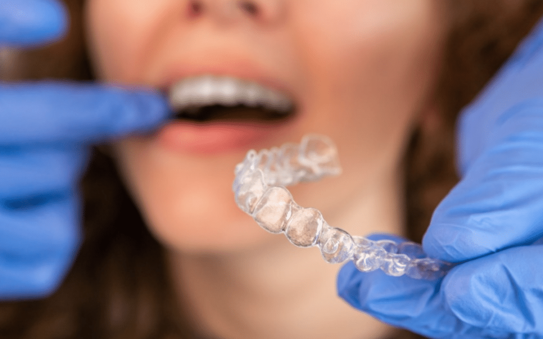 Delays in Invisalign Treatment: Common Issues Explained