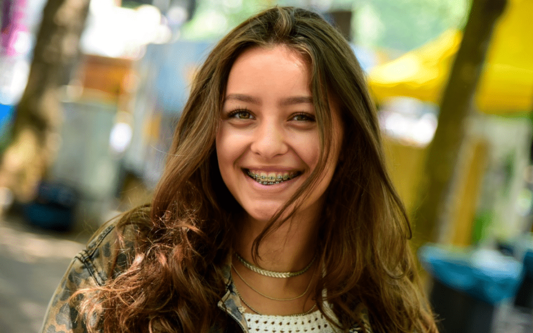 Can Braces Change Your Face Shape? The Truth Behind Orthodontic Transformations