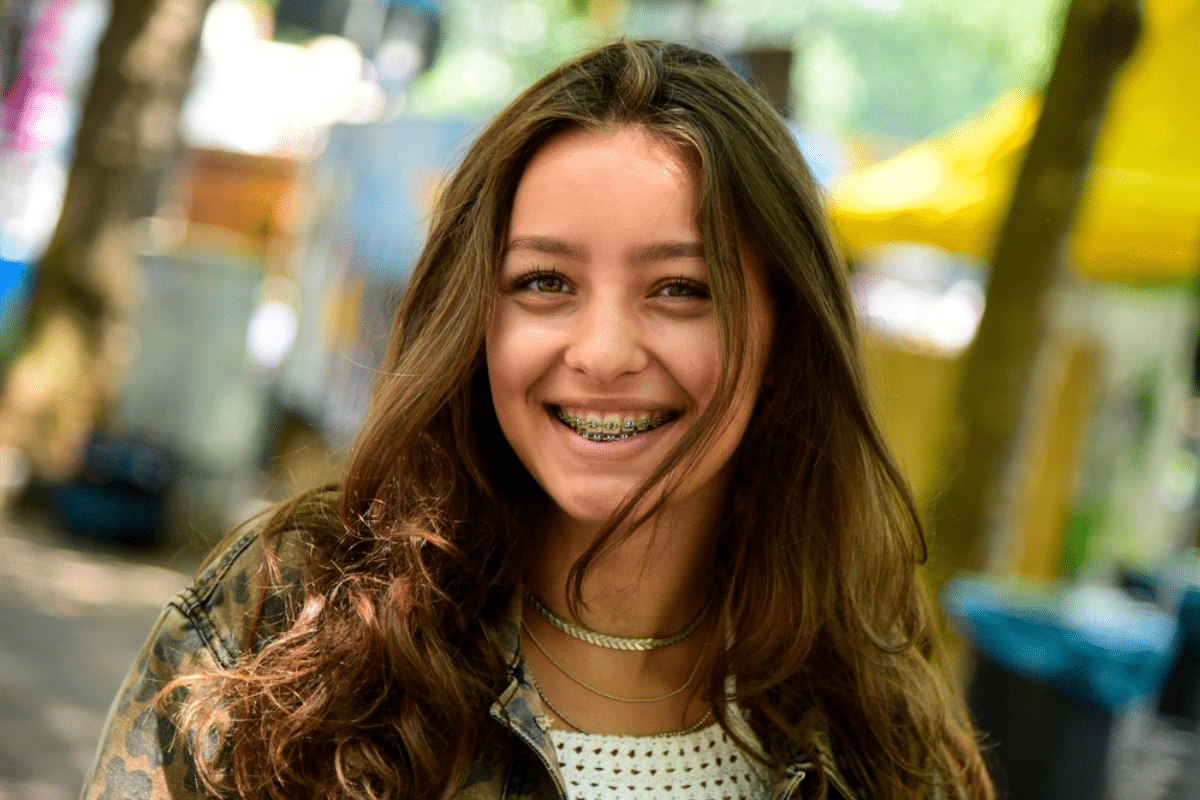 Do Braces Change Your Face Shape?