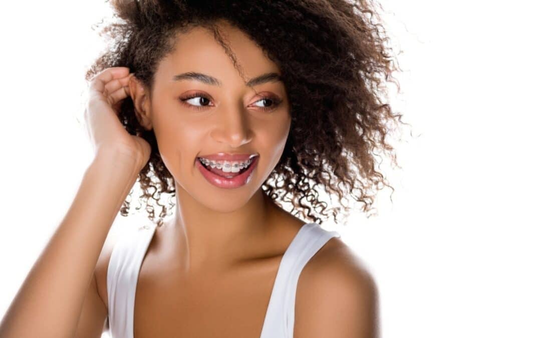 From Clear Aligners to Brackets: Why Some Choose Braces Mid-Treatment