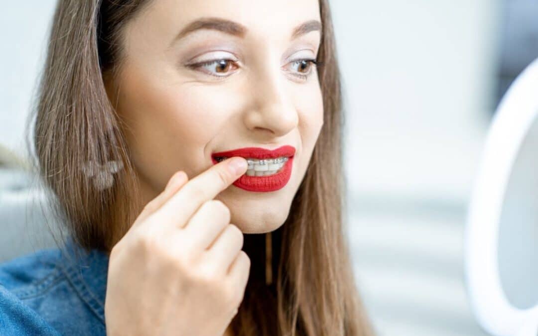 Can I Do Oil Pulling If I Have Braces? Hereās What Orthodontists Say