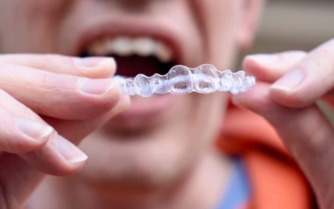 Can I Wear My Last Invisalign Tray as a Retainer? Hereās the Truth