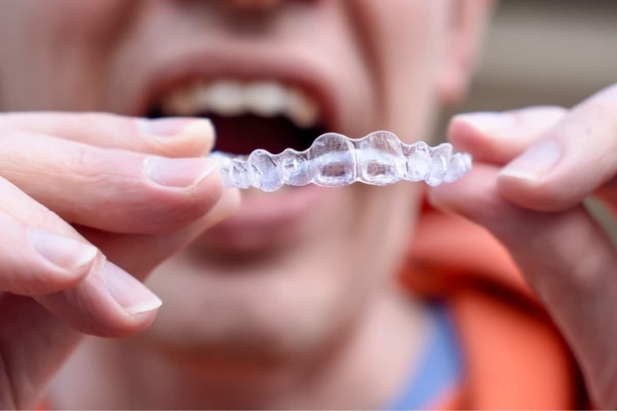 wearing invisalign in merrick tray as retainer pros and cons