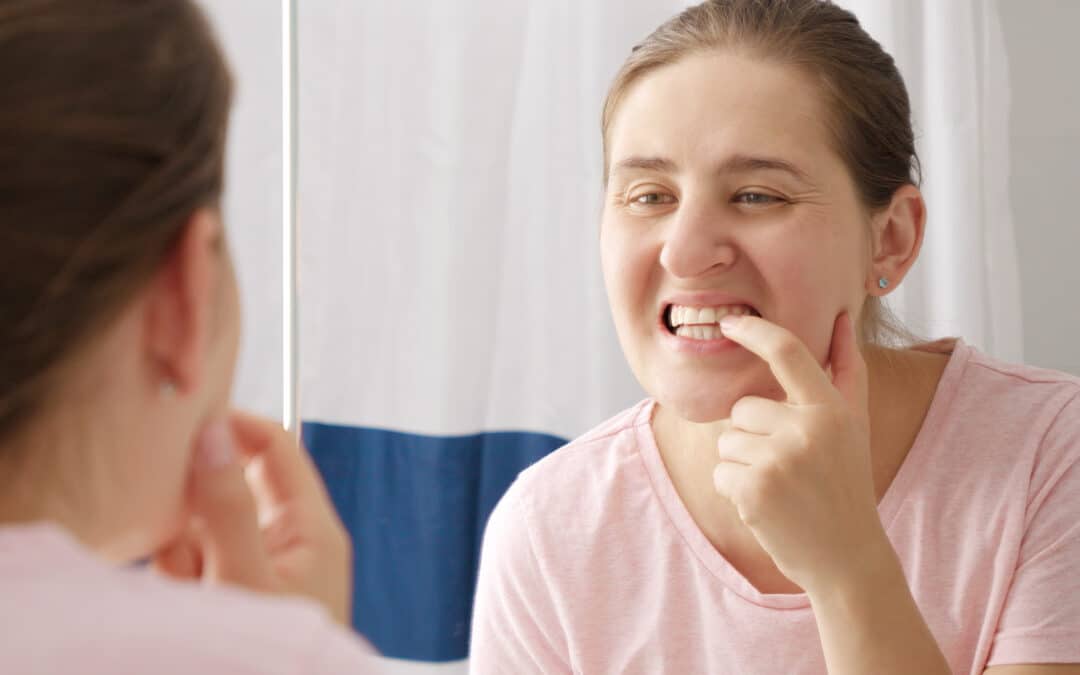Bleeding Whenever You Insert Your Retainer? Here’s What It Could Mean