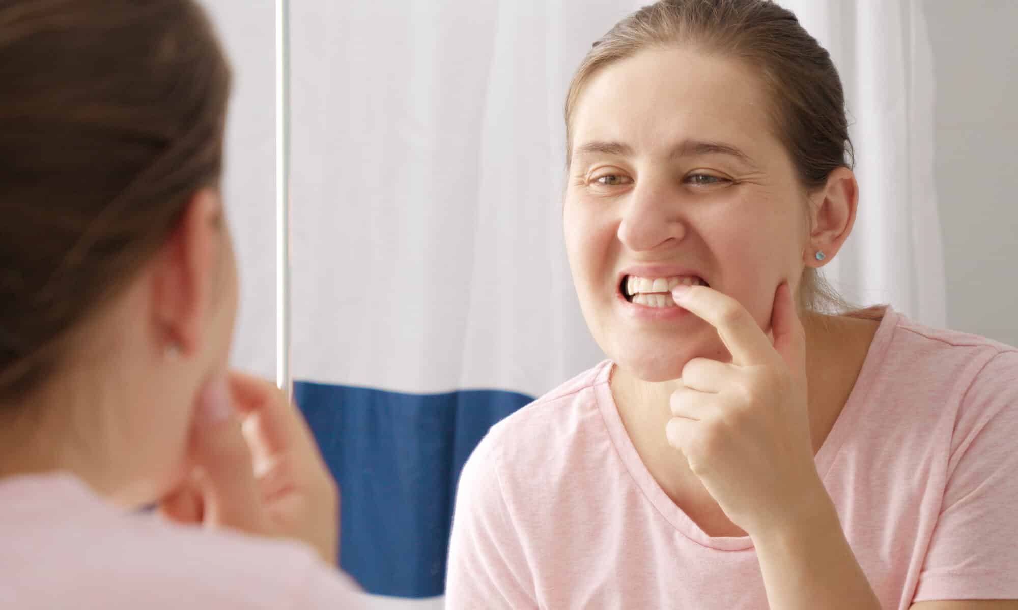 retainer causing gum bleeding solutions by orthodontists in maspeth