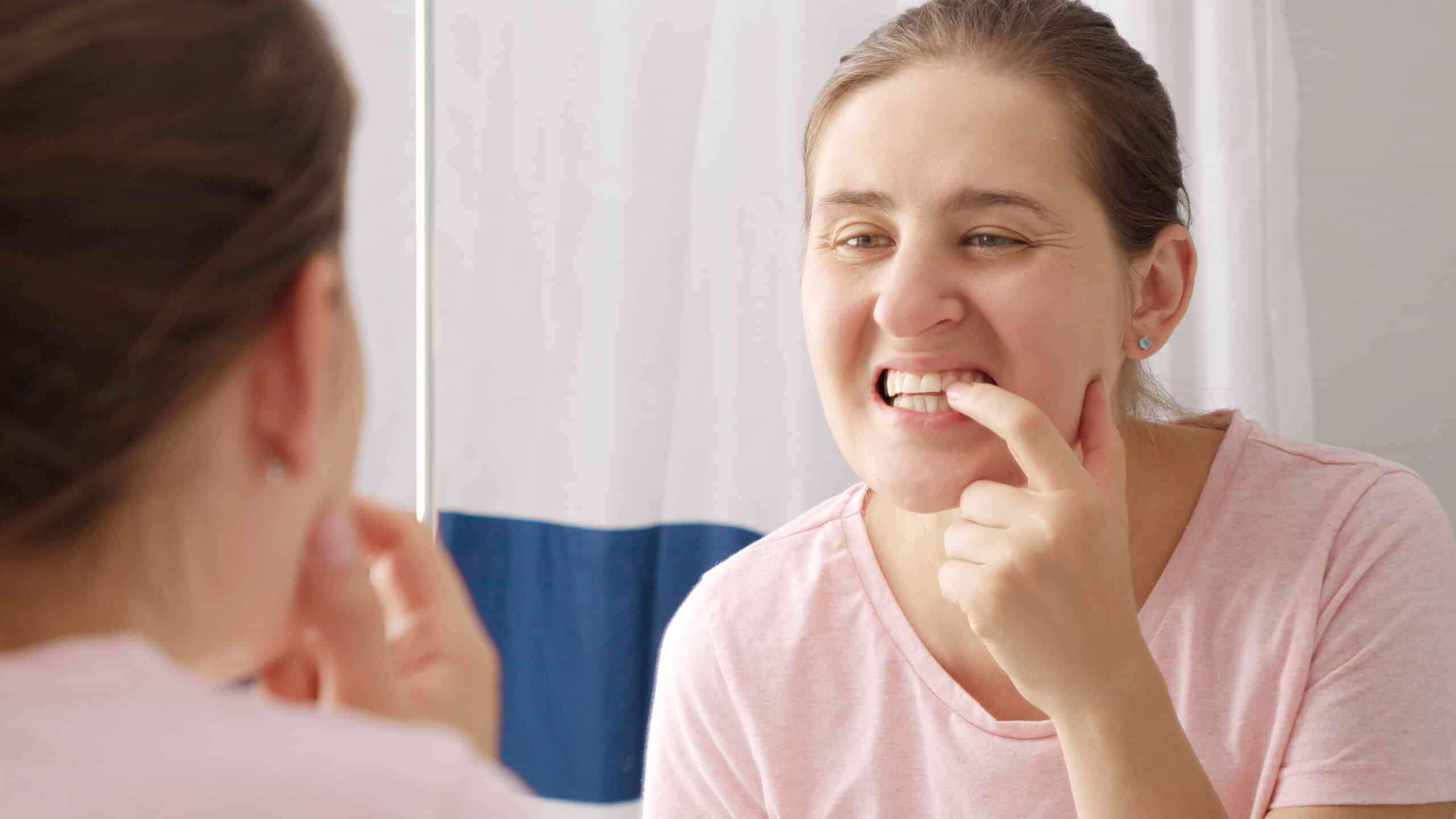 retainer causing gum bleeding solutions by orthodontists in maspeth retainer causing gum bleeding solutions by orthodontists in maspeth
