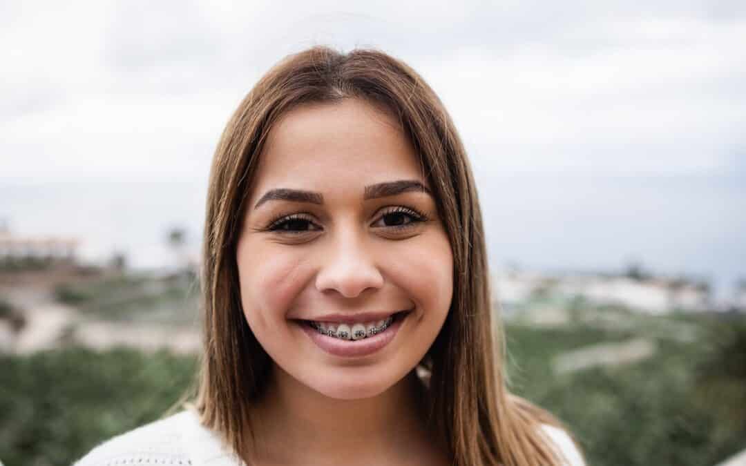 Understanding Common Orthodontic Issues: Overbite, Underbite, and Crowding Explained