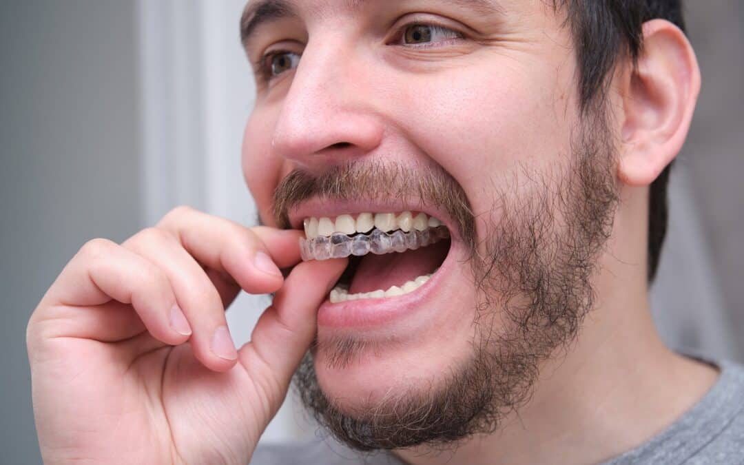 Oil Pulling vs. Mouthwash: What Works Best During Invisalign Care