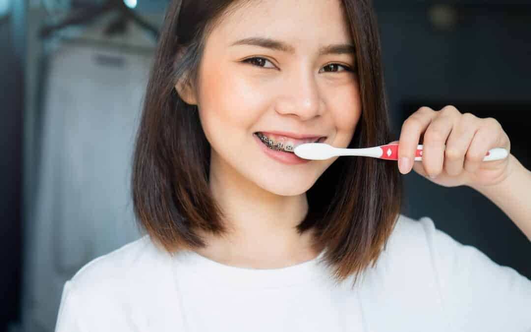 Struggling With Plaque While Wearing Braces? Here’s What Helps