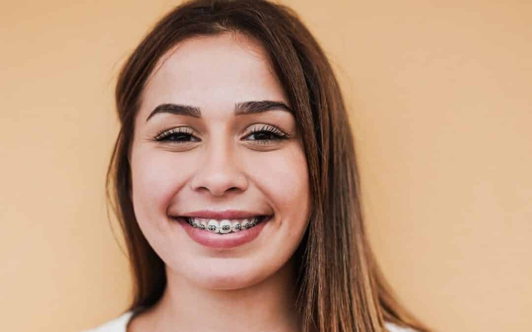 Common Myths About Braces and Facial Slimming—Debunked by Orthodontists