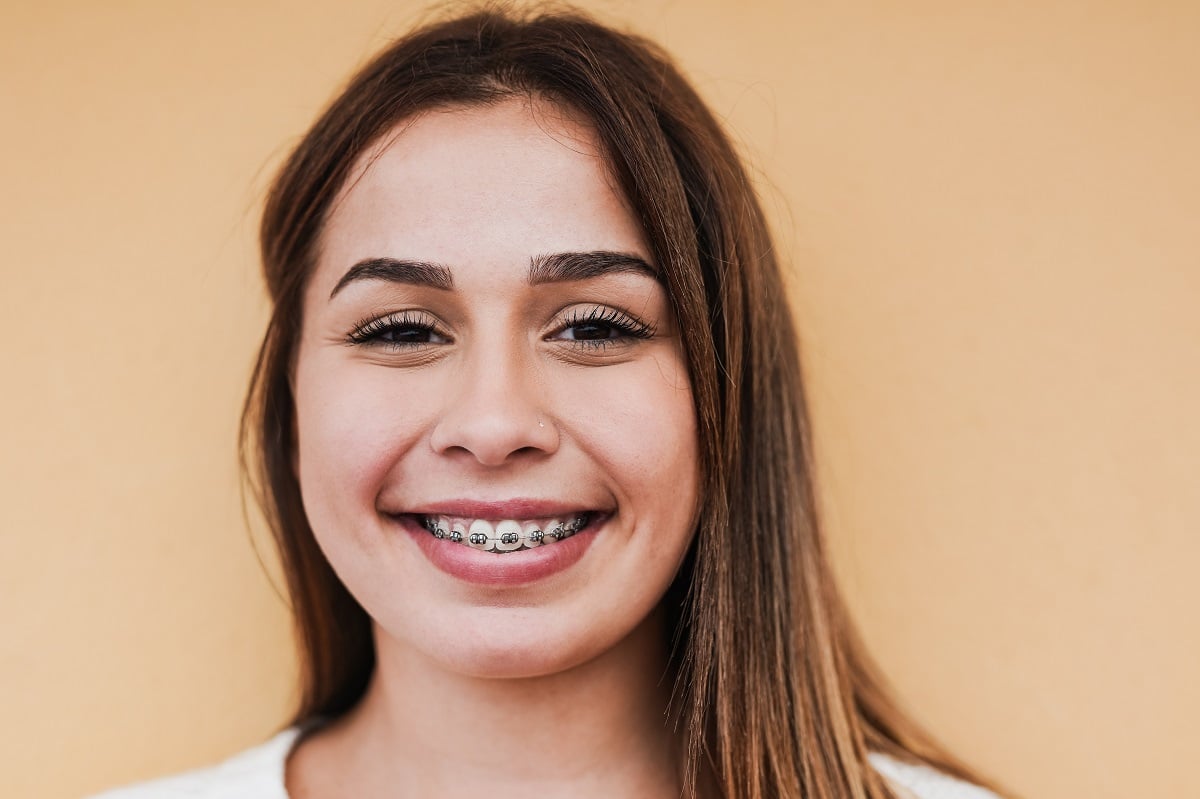 braces and face shape myths explained braces in jericho