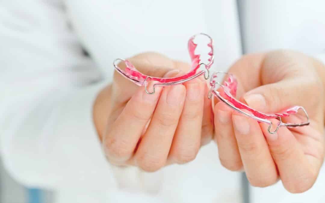 Do You Really Have to Wear Retainers Forever After Invisalign? The Honest Truth