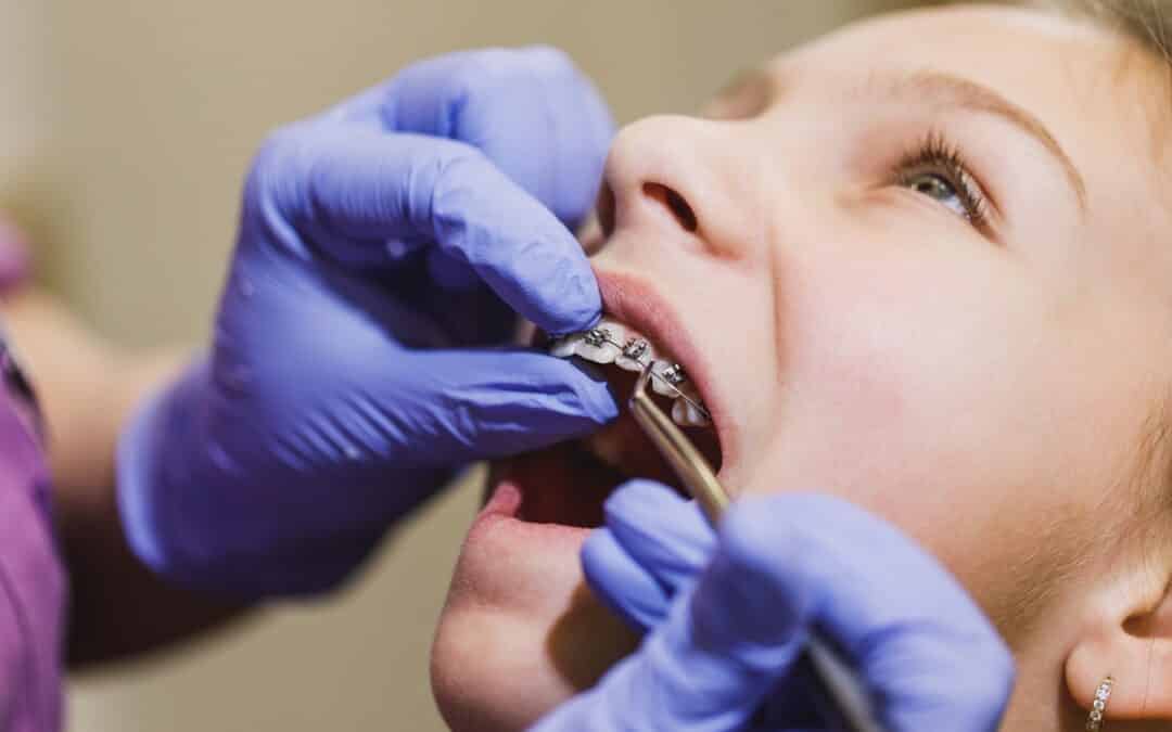 Are Your Braces Damaged? 5 Warning Signs Maspeth Patients Shouldn’t Ignore
