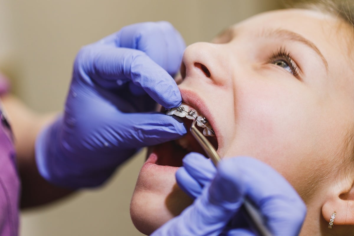 braces problems warning signs orthodontist near maspeth