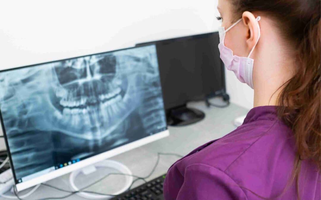 Can AI Plan Invisalign Without an Orthodontist?