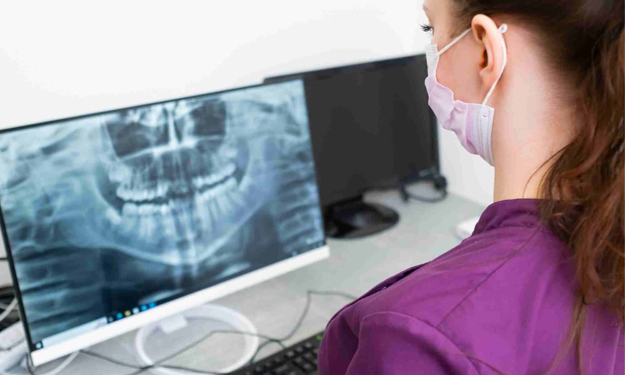 AI-assisted Invisalign treatment planning using a dental X-ray