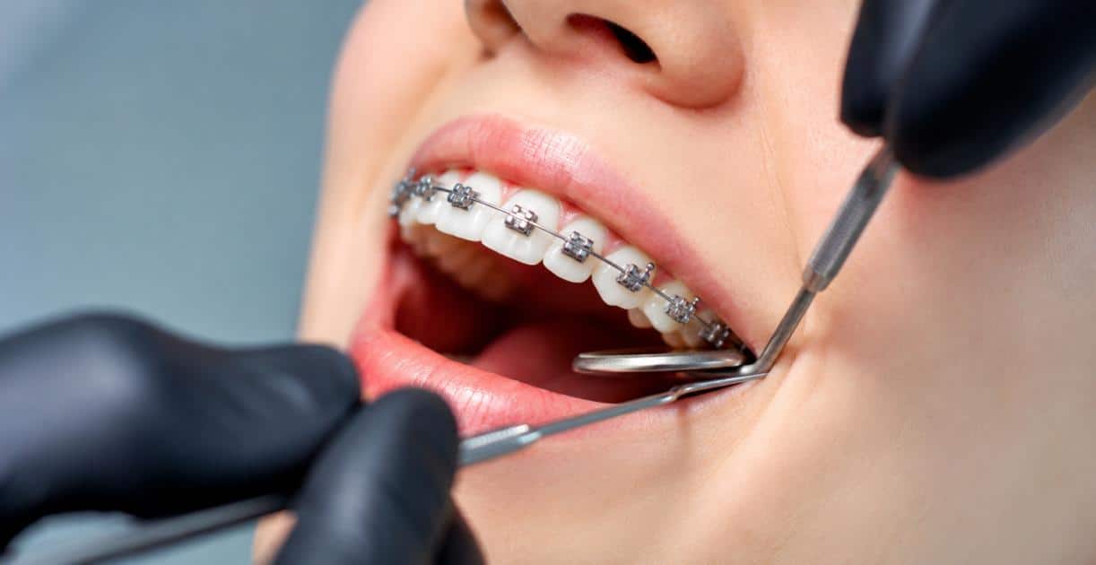 Orthodontist in Jericho, NY Woman with braces getting an orthodontic evaluation for a teeth gap during treatment.
